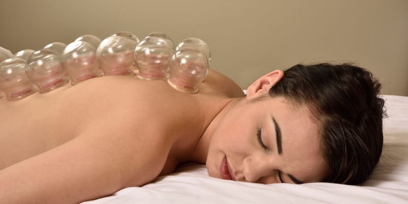 Benefits of Cupping Therapy and Why You Might Want to Try It